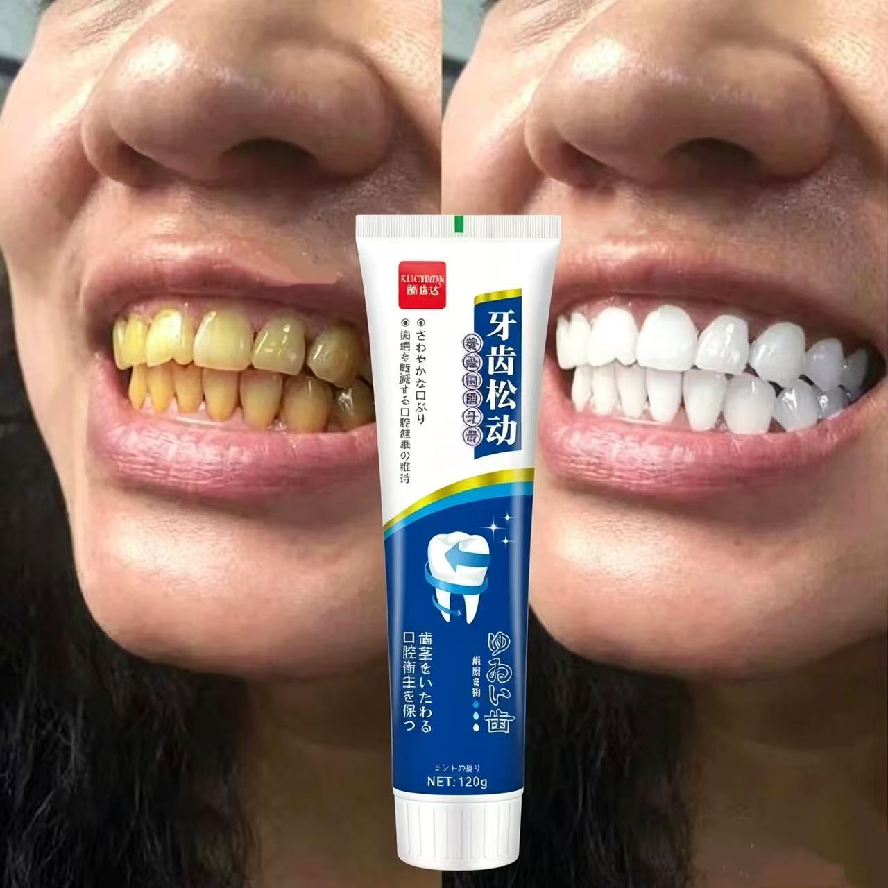 Teeth Whitening Japan - Pasta Gigi Impor Jepang untuk Memperbaiki