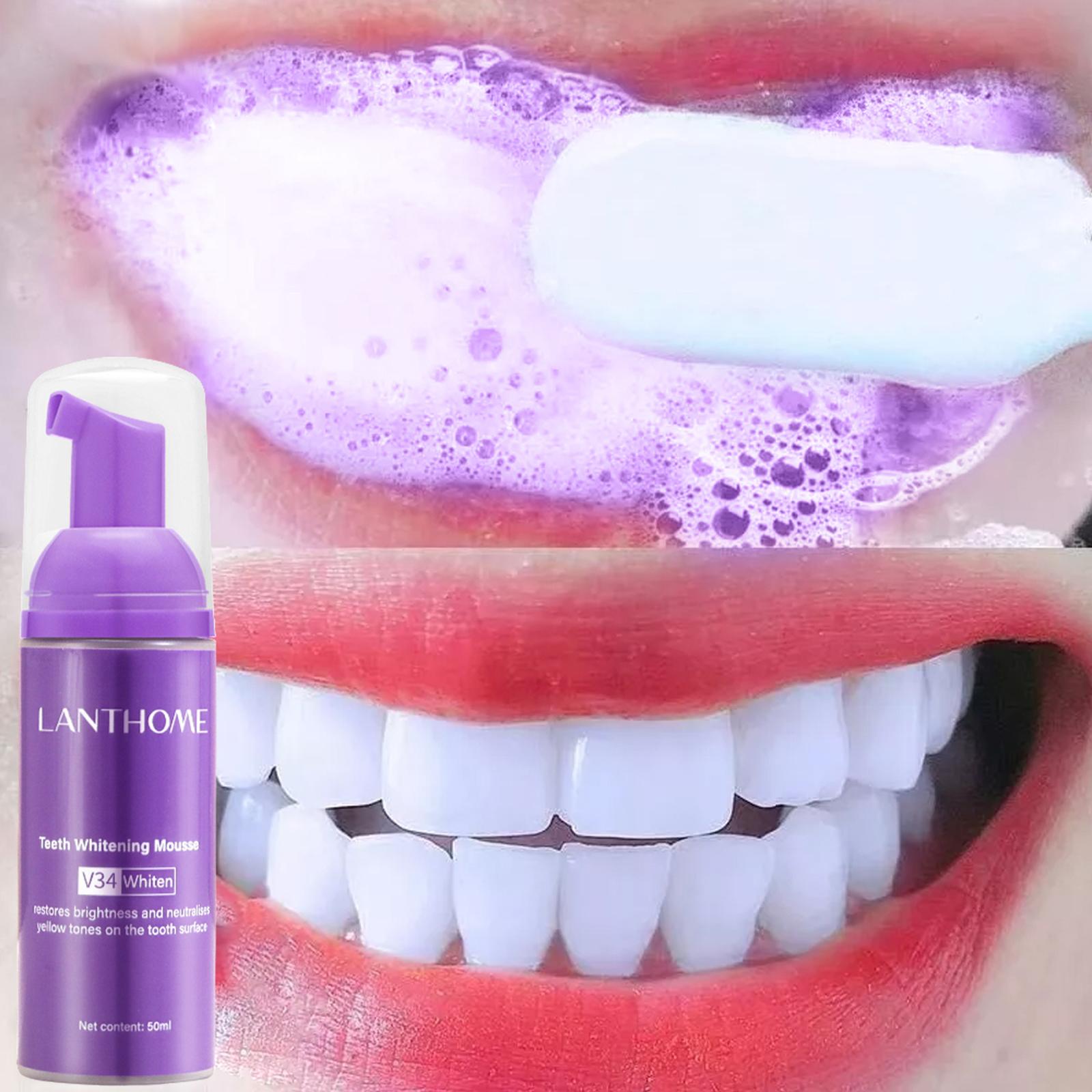 Teeth Whitening Mousse - Mousse pemutih gigi 50 mldental, menghilangkan