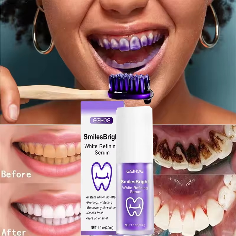 Pasta Gigi Pemutih Pembersih G - Teeth Whitening In Korea ulasan dan harga