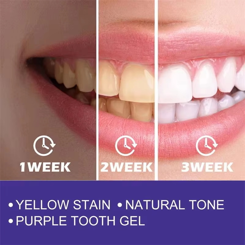 Pasta Gigi Pemutih Pembersih G - Teeth Whitening In Korea ulasan dan harga