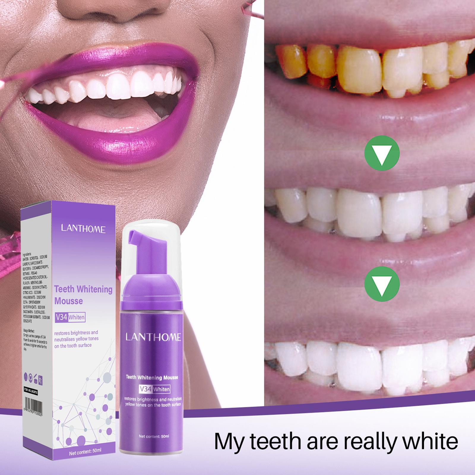 Mousse pemutih gigi 50 mldenta - Teeth Whitening Mousse ulasan dan harga