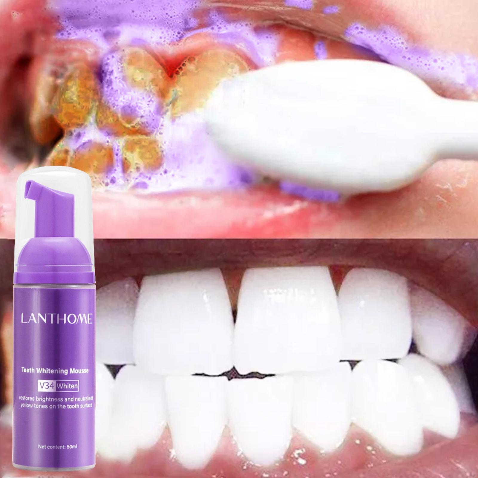 Mousse pemutih gigi 50 mldenta - Teeth Whitening Mousse ulasan dan harga