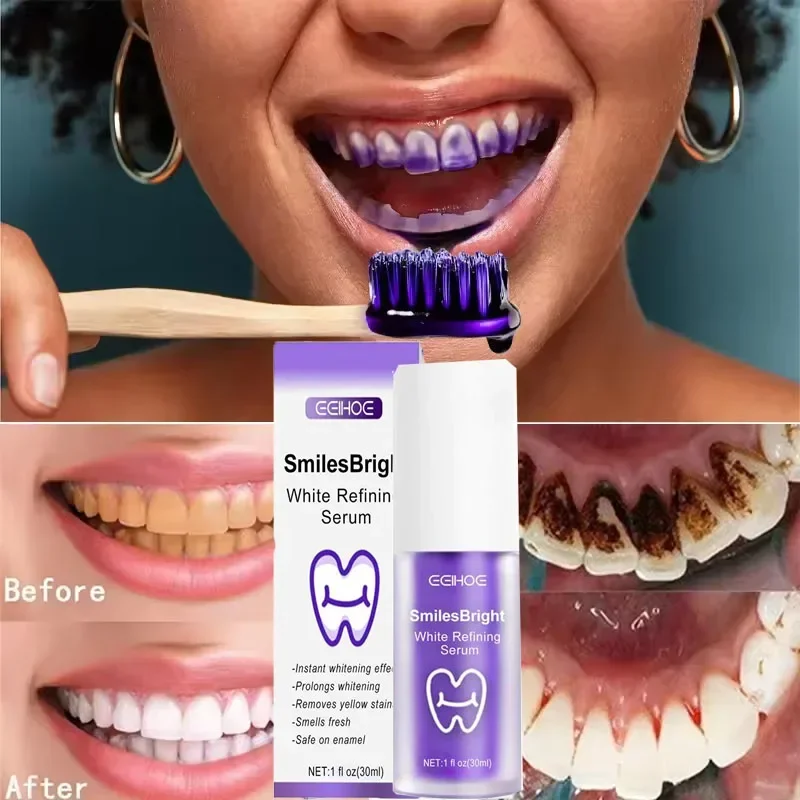 Pasta Gigi Pemutih Pembersih G - Teeth Whitening In Korea ulasan dan harga