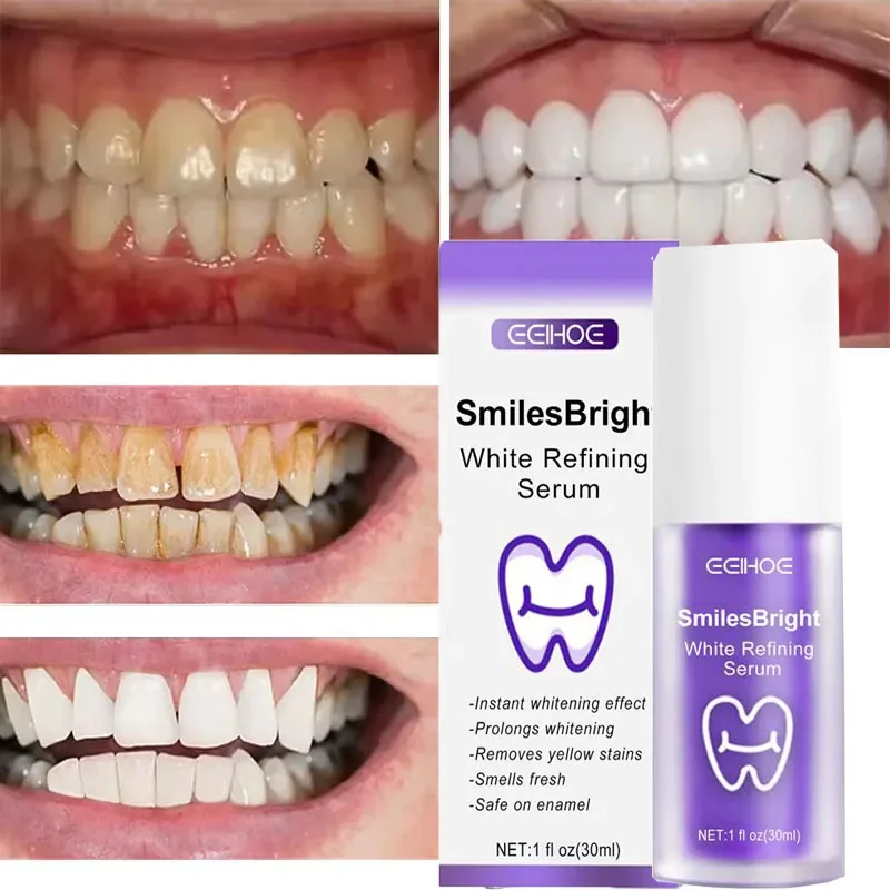 Pasta Gigi Pemutih Pembersih G - Teeth Whitening In Korea ulasan dan harga