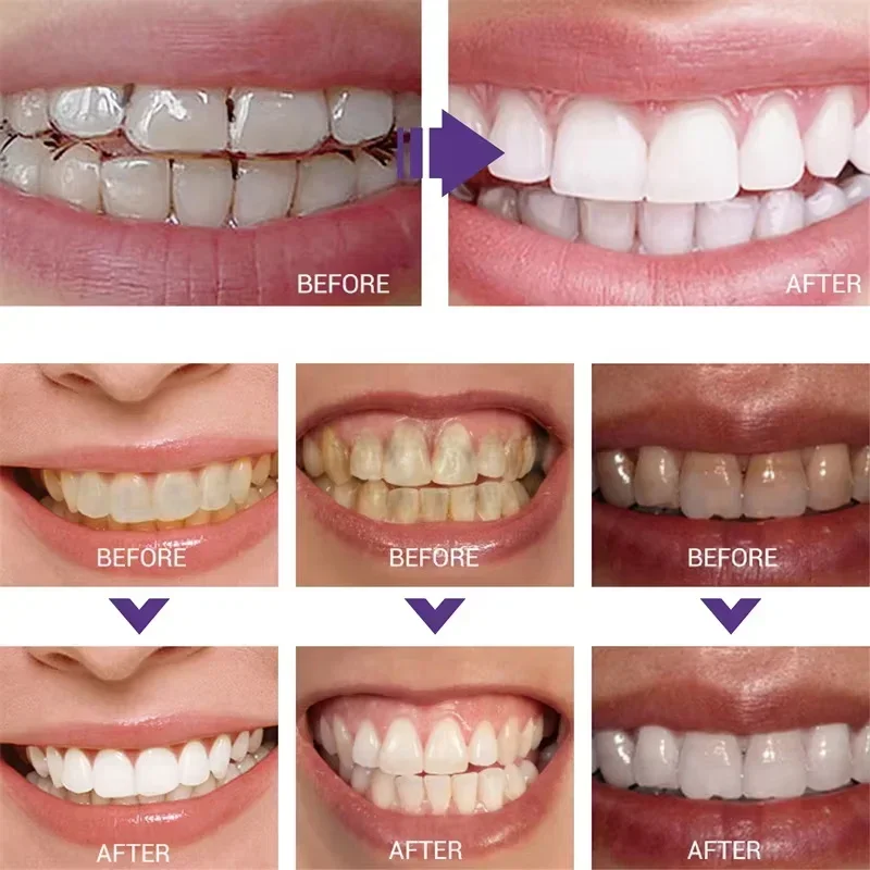 Pasta Gigi Pemutih Pembersih G - Teeth Whitening In Korea ulasan dan harga