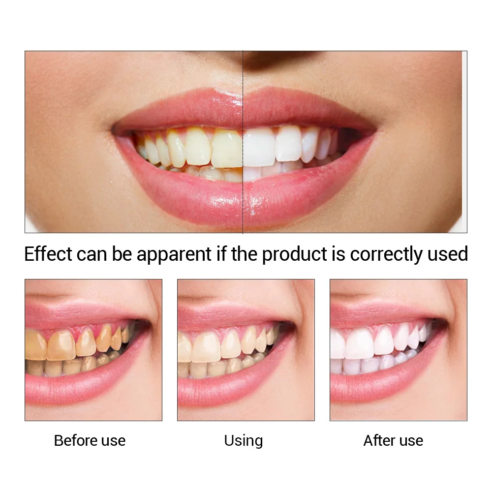 FTEENPLY Bubuk Esensi Pemutih  - Teeth Whitening Price ulasan dan harga