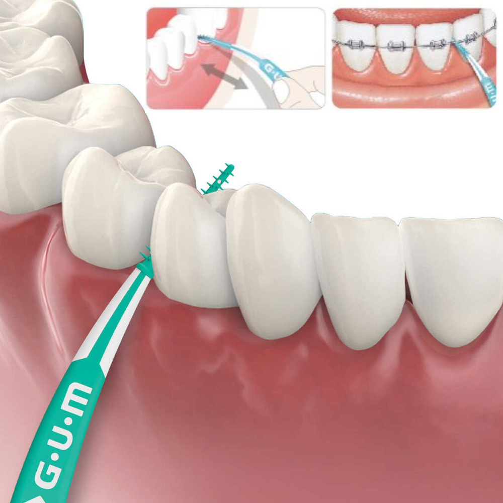 Stik Lembut Gusi Sikat Pembers - Teeth Whitening Japan ulasan dan harga