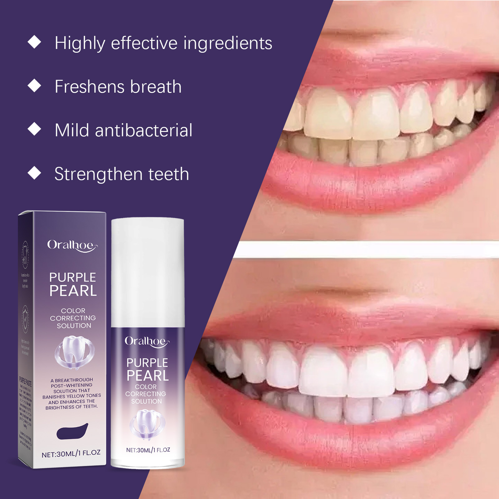 Teknologi Mousse Pemutih Gigi  - Teeth Whitening Mousse ulasan dan harga
