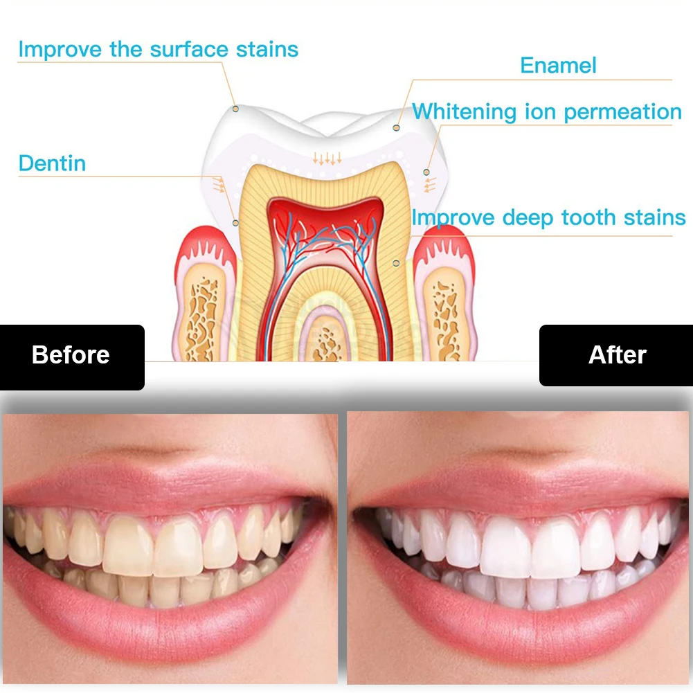 Kit pemutih gigi Mini 16 LED c - Teeth Whitening Price ulasan dan harga
